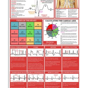 Anatomy Of The ECG Waveform Cardiologist Poster, Canvas
