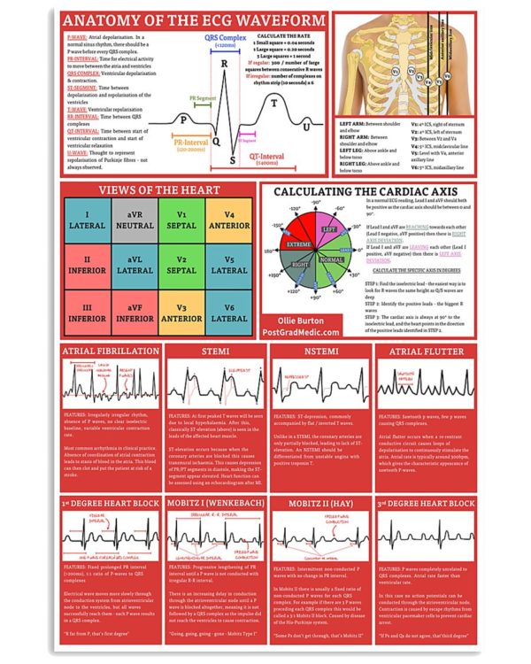 Anatomy Of The ECG Waveform Cardiologist Poster, Canvas