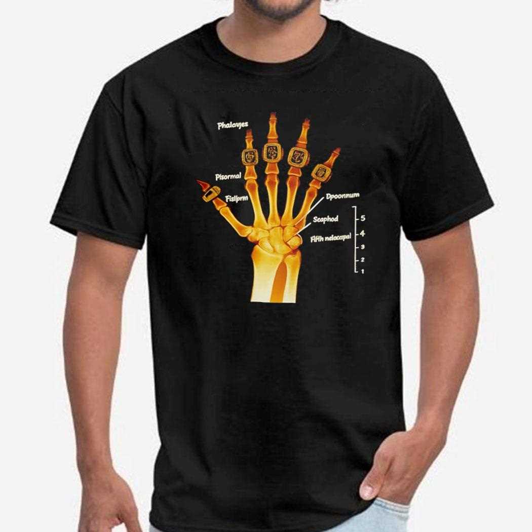 Kobe Bryant La Lakers X-ray Broken Torn Scapholunate Ligament Shirt Kobe Bryant La Lakers X-ray Broken Torn Scapholunate Ligament Shirt