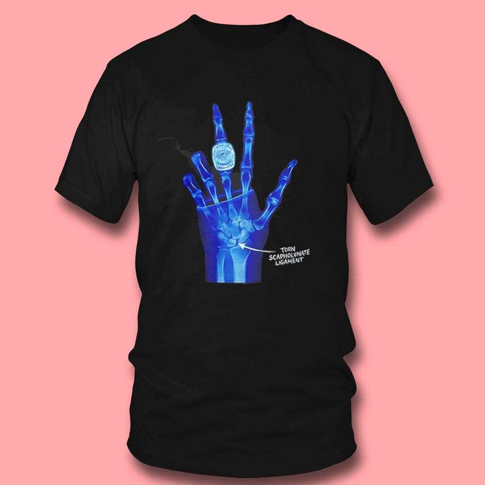 Kobe Bryant La Lakers X-ray Broken Torn Scapholunate Ligament Shirt Kobe Bryant La Lakers X-ray Broken Torn Scapholunate Ligament Shirt